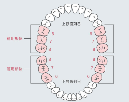 保険適用奥歯白い歯